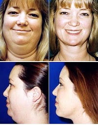 Cosmetic Surgery London 379911 Image 5